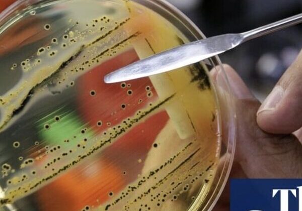 Petri dish with bacterial colonies and tool.